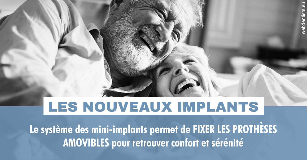 https://dr-philippe-nozais.chirurgiens-dentistes.fr/Les nouveaux implants 2