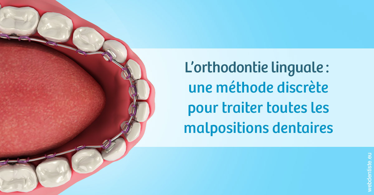 https://dr-philippe-nozais.chirurgiens-dentistes.fr/L'orthodontie linguale 1
