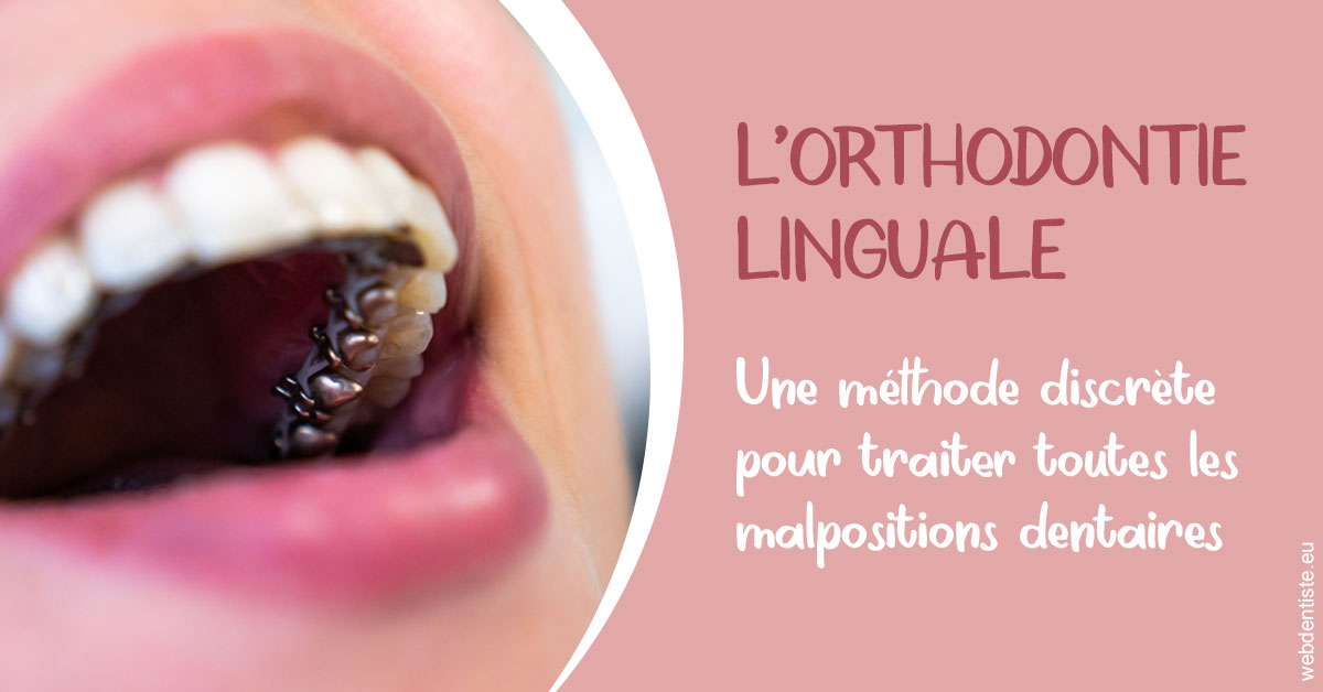https://dr-philippe-nozais.chirurgiens-dentistes.fr/L'orthodontie linguale 2