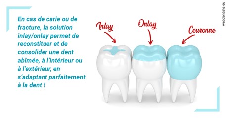 https://dr-philippe-nozais.chirurgiens-dentistes.fr/L'INLAY ou l'ONLAY
