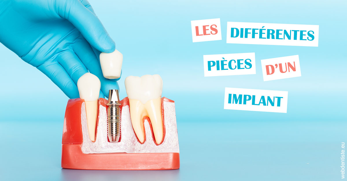 https://dr-philippe-nozais.chirurgiens-dentistes.fr/Les différentes pièces d’un implant 2
