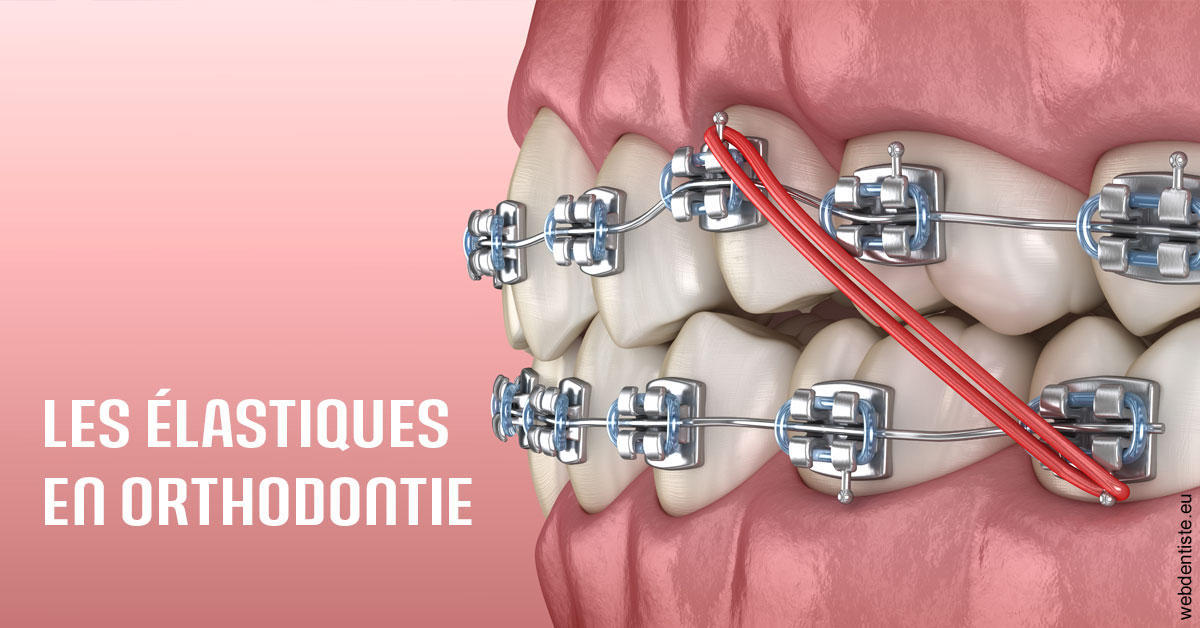 https://dr-philippe-nozais.chirurgiens-dentistes.fr/Elastiques orthodontie 2