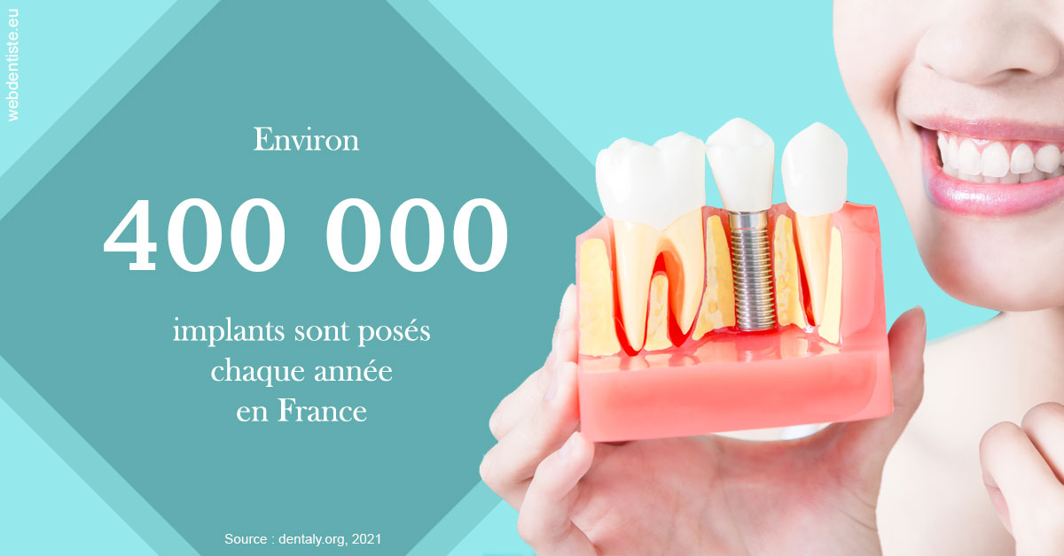 https://dr-philippe-nozais.chirurgiens-dentistes.fr/Pose d'implants en France 2
